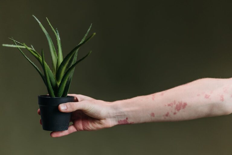 Netelroos bij kinderen: wat je moet weten over deze jeukende huiduitslag Netelroos bij kinderen: wat je moet weten over deze jeukende huiduitslag