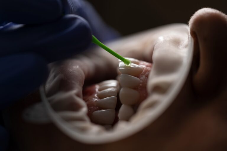 Dentius Wilrijk: wat je moet weten over deze tandartspraktijk
